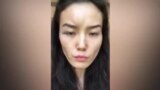 Жена казахстанского дипломата рассказала, что муж ее десять лет избивал: МИД отозвал мужчину на родину